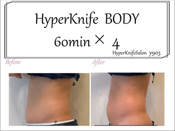 ワイキューマルサン(y903)/上半身60分×4回