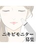 人数限定【☆しみケア/ニキビケア☆モニター募集】2回¥30,000/5回¥50,000