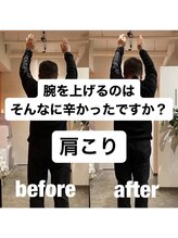 カワル整体 上通り院/【肩こり影響が肩の可動域にも】