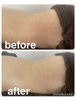 ギンザアール(GINZA R.)/腰痛改善に！