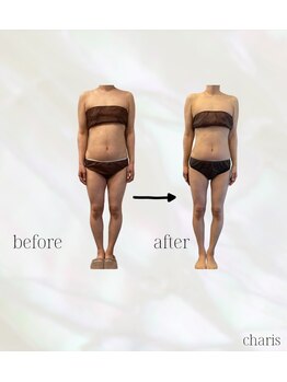 カリス(charis)/お腹＆腰回りスッキリ！