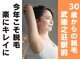 シャーロック 脱毛(4869 Sherlock)の写真