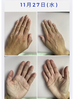 リレフー(Relafy)/4枚目の続き　たった半年で！