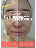 【当店人気No.1】痛いけどクセになる小顔顔筋★70分　¥8800→¥7700