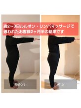 ヨサパーク ライズ 大日(YOSA PARK RISE)/BeforeAfter 