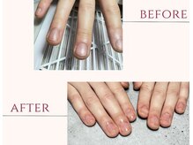 剥がれやすい方もご相談ください◎