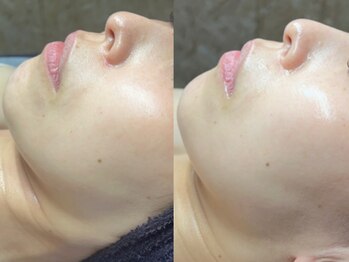 エモーショナル 姫路(Emotional)/ララピール+LDM2年目【くすみ】