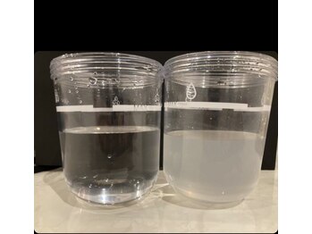 レコルト デ ベルシア BELCIA福岡店(recolte de BELCIA)/ハイドラ汚れかなり取れます