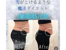 ラフィール/脂肪冷却ダイエット:痩身