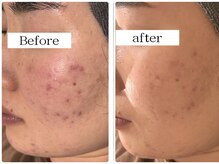 小さな悩みも教えて下さい。しっかりカウンセリング致します。