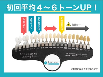 ライトビューティー 武蔵小杉店(Light Beauty)の写真