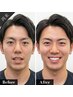【ホワイトニング】メンシプ用/顔の印象は口元と眉毛で決まる！喫煙者も