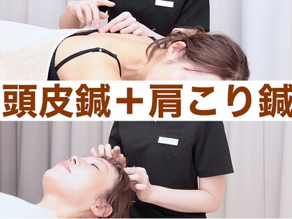 神戸はりのわ鍼灸院の写真