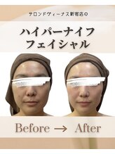 エステティックサロン サロン ド ヴィーナス 新宿店/