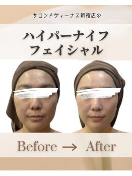 エステティックサロン サロン ド ヴィーナス 新宿店/