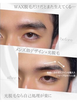 リノア(Linoa)/メンズ眉毛ビフォーアフター