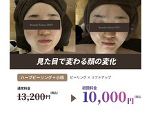 ジンク(ZINC)の雰囲気(毛穴ケアと小顔ケア、一度に叶う贅沢コース)