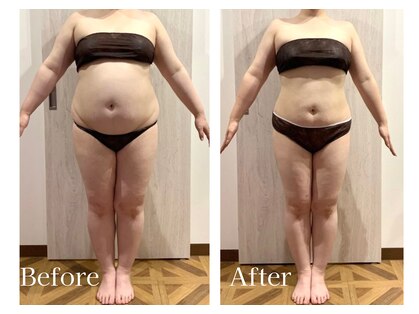 アイニティ ボディ トーニング 赤坂(INITY BODY TONING)の写真