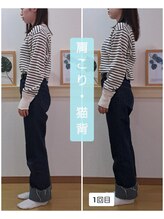 ポノ(Pono)/肩こり・猫背矯正