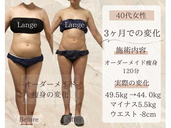 サロン ド ボーテ ラーンジュ 岐阜店(salon de beaut'e L'ange)/ハイパ-ナイフEX2ダイエット痩身