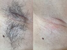 ディスイズミー シュガーリング(This is me Sugaring)