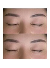 バニーアイズ 天神(Bunny eyes TENJIN)/アイブロウワックス脱毛