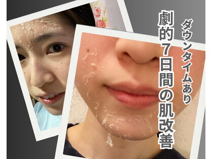 リオル(Rior)の写真