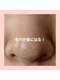 キヨラ(kiyora)の写真/毛穴が変われば、肌印象が変わる。肌質改善のプロが提案する毛穴徹底攻略メニュー☆
