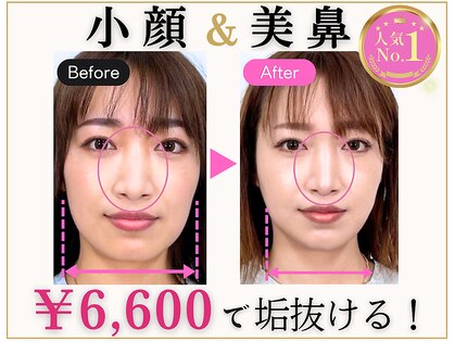ラプリボーテ(Raplit BEAUTE)の写真