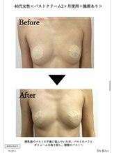 カナエル(QANAEL)/バストケアクリーム効果1