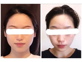 アゴラ/【小顔】豊富な施術実績有り