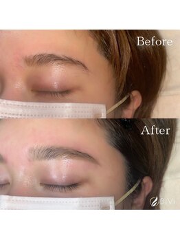 ボアップ(boappu)/美眉