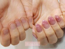ミンスネイル(Mins Nail)/深爪長さ出しbefore&after