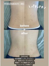 ミア(Mia)/スロータスボディ90分