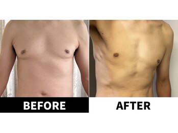 ありがとうパパの腸もみサロン アンド スクール/ビフォーアフター