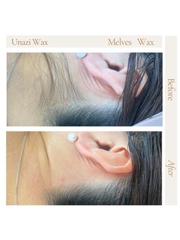 メルベスワックス(MELVES WAX)/うなじダブル脱毛