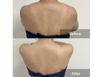 プリマルーチェ/プレミアム花嫁様プログラム