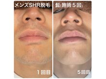 ネイキッドベージュ 恵比寿店(Naked Beige)の雰囲気（担当のスタッフがお客様に最適な方法で脱毛致します♪指名もOK★）