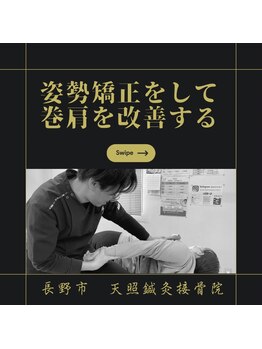 天照鍼灸接骨院/姿勢矯正で巻肩を改善する