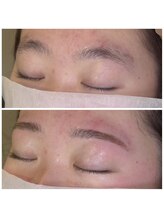 BWサロン(BW salon)/おまかせデザイン眉毛脱毛