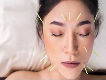 アサバ整体院 三ノ輪店(ASABA整体院)の写真/【たるみ・ほうれい線改善】効果実感&速効性◎小顔リフトアップに人気の美容鍼◎小顔×肌質改善が叶う♪