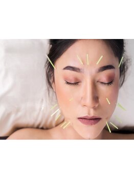 鍼灸施術を受けたい