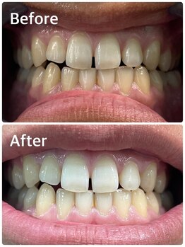 プラチナムビューティー 横須賀店/ビフォーアフター