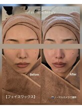ルフ エステティック ビューティー(ruf esthetic beauty)/フェイスワックス