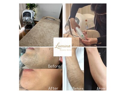 ルミナ(Lumina)の写真