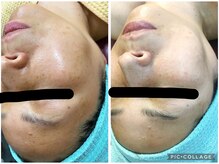 ラヴィアンローズ 津島店(La vie en Rose)/◇ビフォーアフター◇