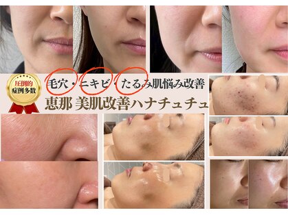 ハナ チュチュ(Hana chuchu)の写真