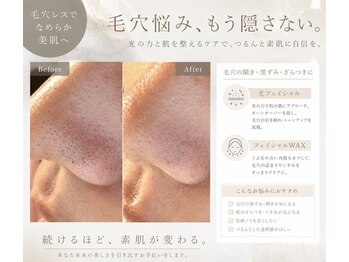 リベラサロン(LIBERA SALON)の写真/毛穴、まだ隠しますか？”素肌び自信”を作る毛穴ケアを