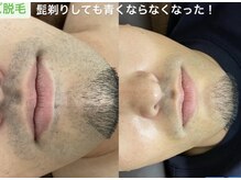 ココ(COCO)の雰囲気（うなじ脱毛／背中脱毛／メンズ脱毛／ヒゲ脱毛）