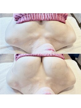 ロココ 水戸店(Rococo)/ハリのあるバストを